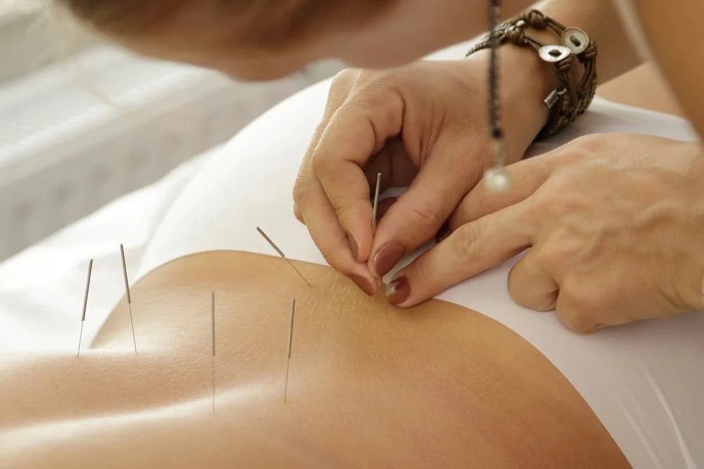 Can Acupuncture Help Relieve Menstrual Cramps? Here’s What You Need to Know! — Acupuncture Xperts, Boca Raton FL