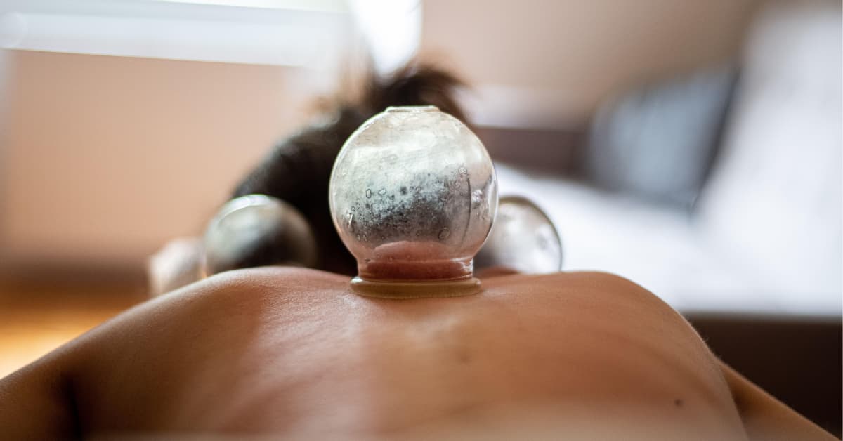 Back cupping therapy session