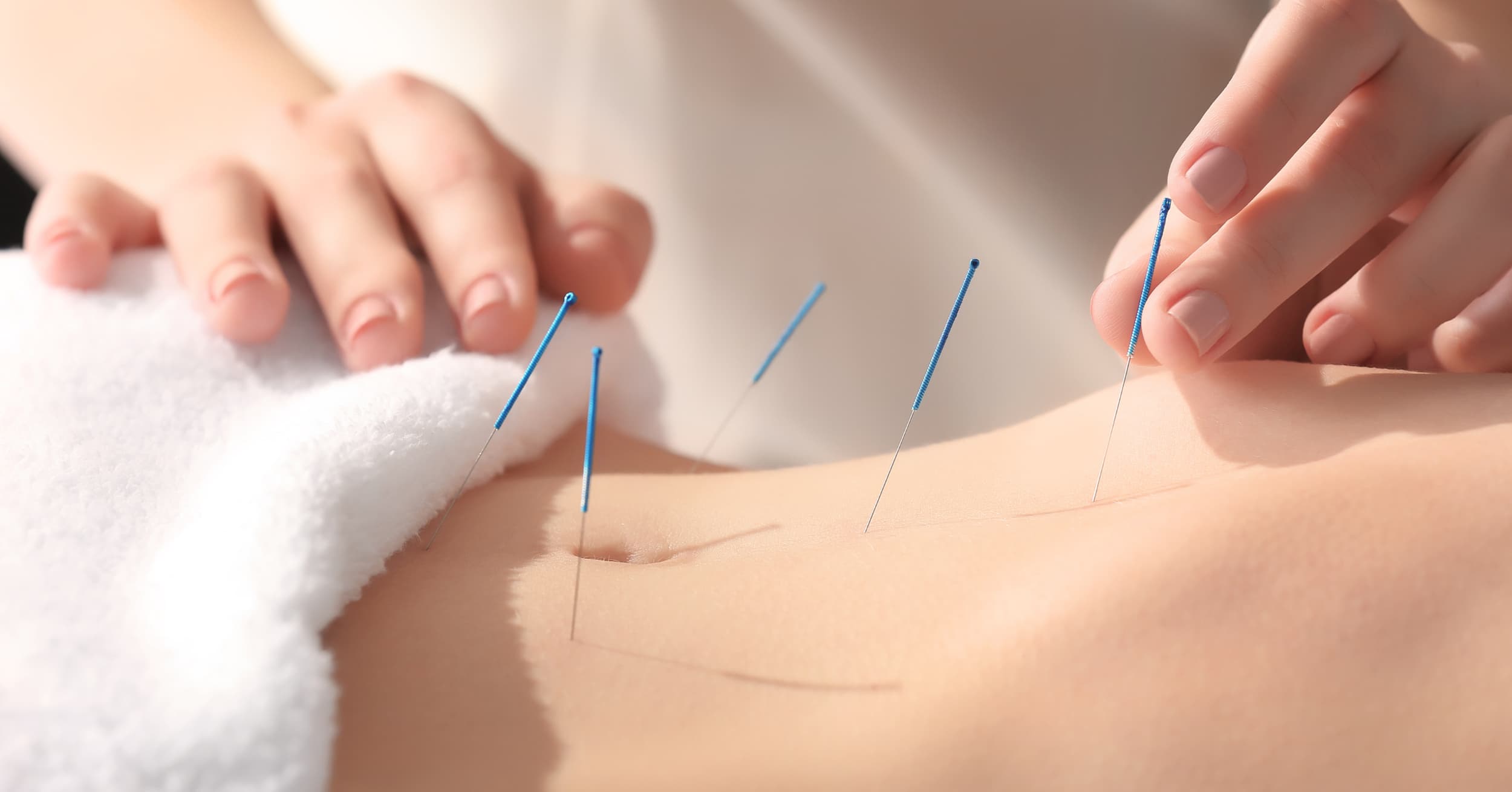Top 10 benefits of acupuncture clinical muscle rehab