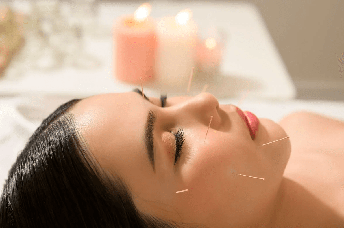 Cosmetic acupuncture facial rejuvenation in Boca Raton