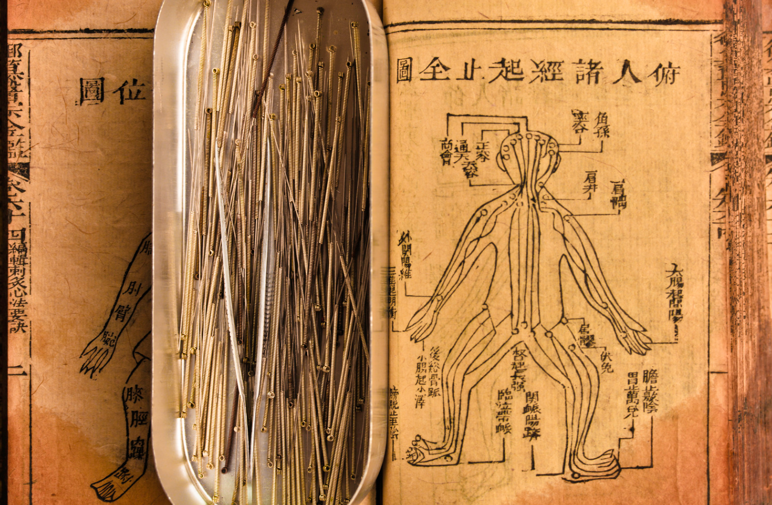 Needles Book