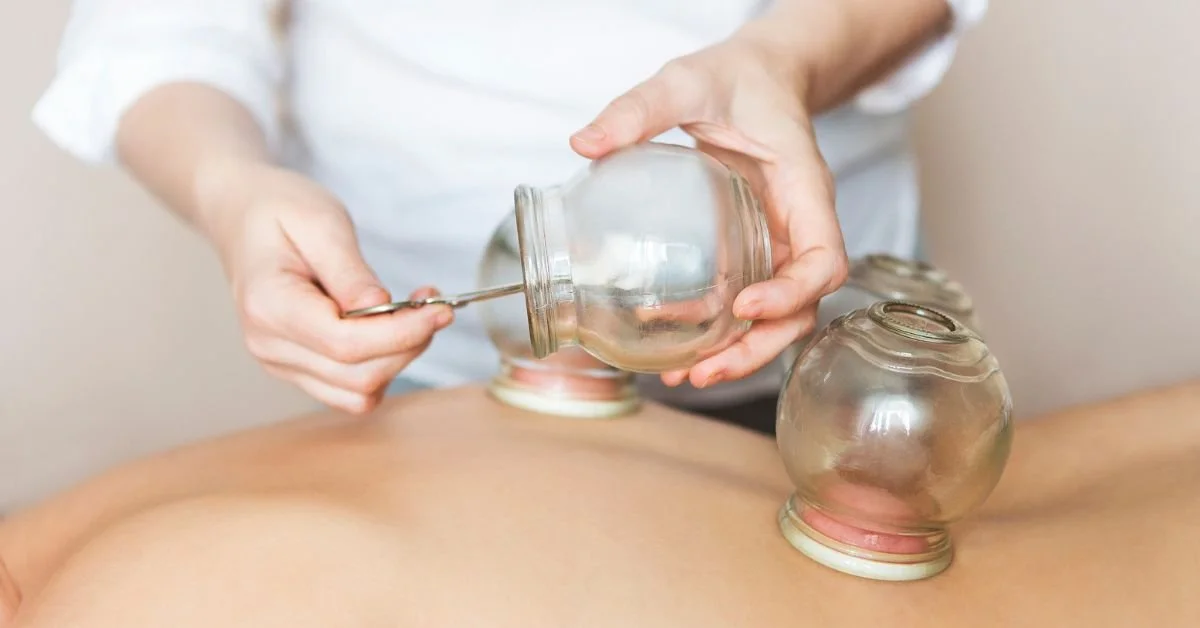 Professional cupping therapy placement