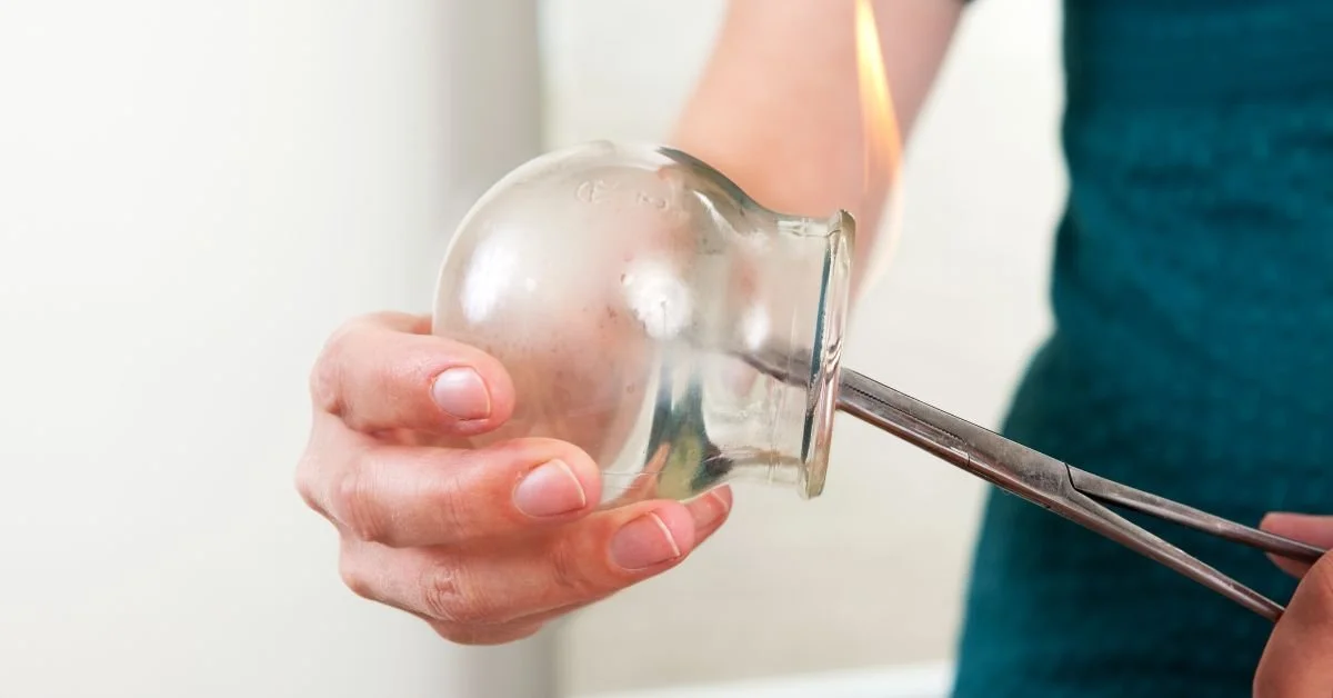 Traditional fire cupping therapy preparation