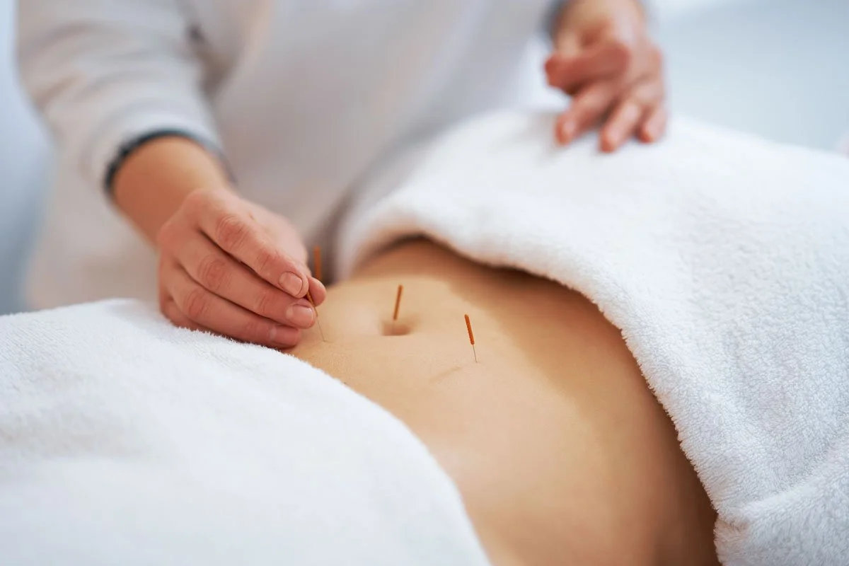 An acupuncturist using acupuncture for neuropathy
