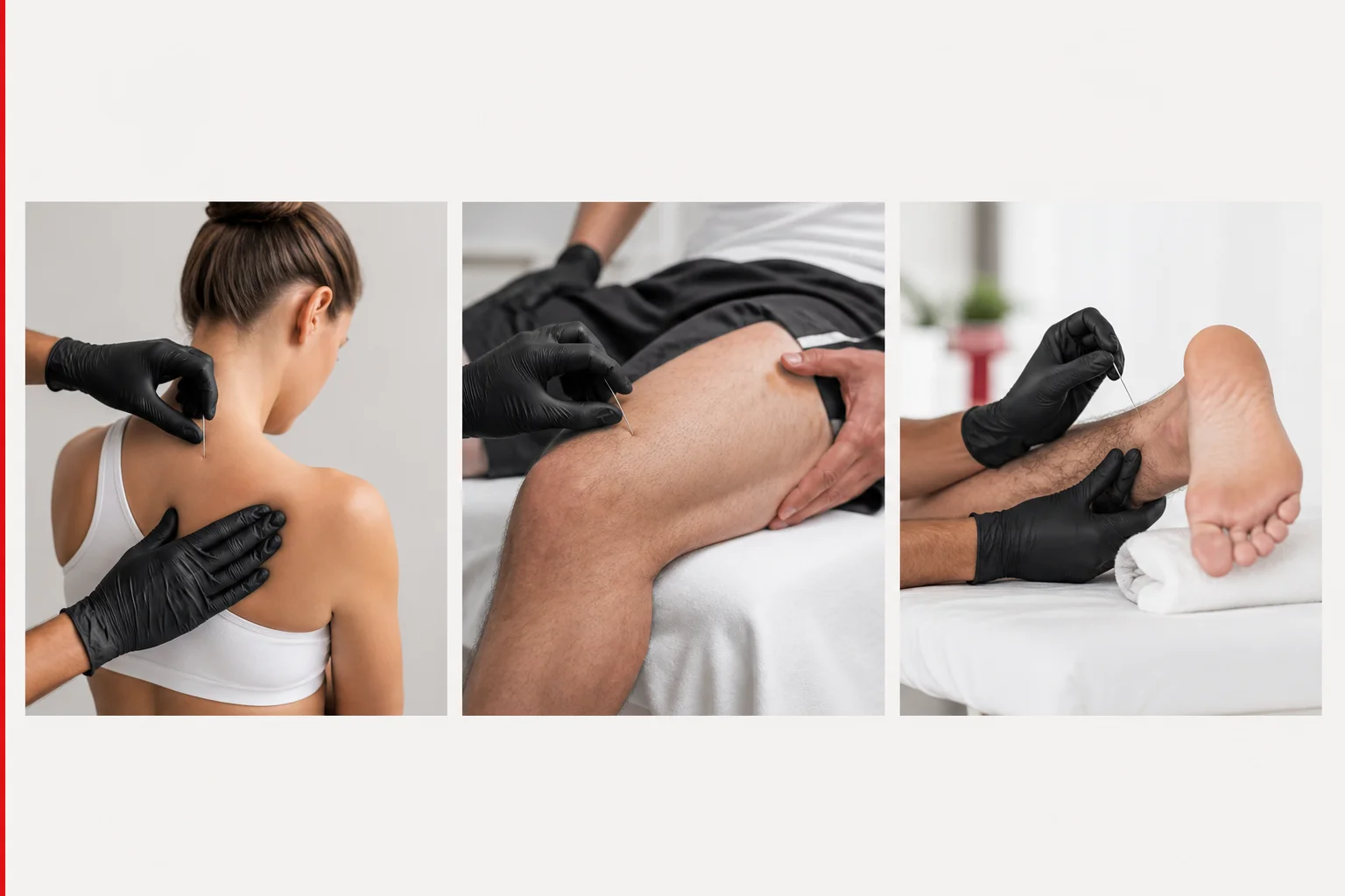 Common problems and body areas addressed with dry needling